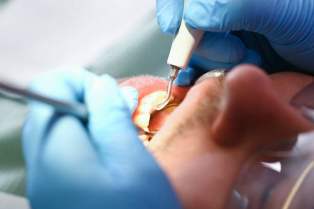 Best Emergency Treatment for Oral Infections in Hidden Valley Lake, CA